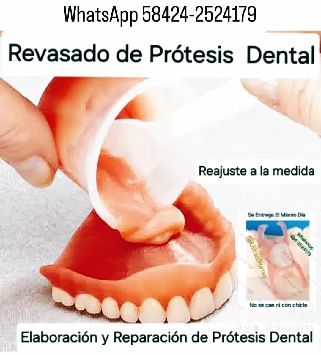 Prótesis dental